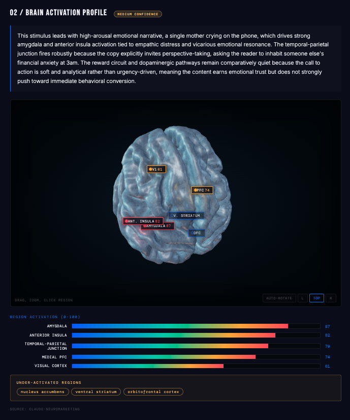 Brain activation profile with 3D region map and bar chart